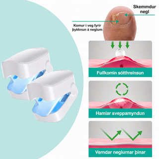 NuvoCare – Blá ljósmeðferð við naglasveppi heima
