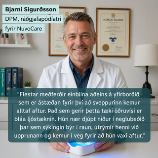 NuvoCare – Blá ljósmeðferð við naglasveppi heima